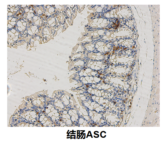 结肠ASC.png