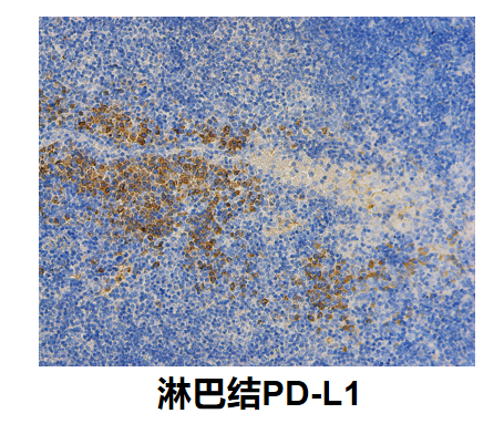 淋巴结PDL1.png