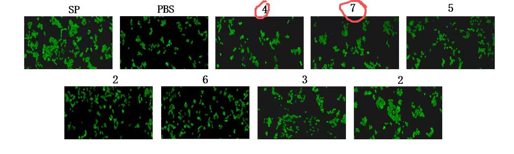 Anti-Substance P（SP）抗体